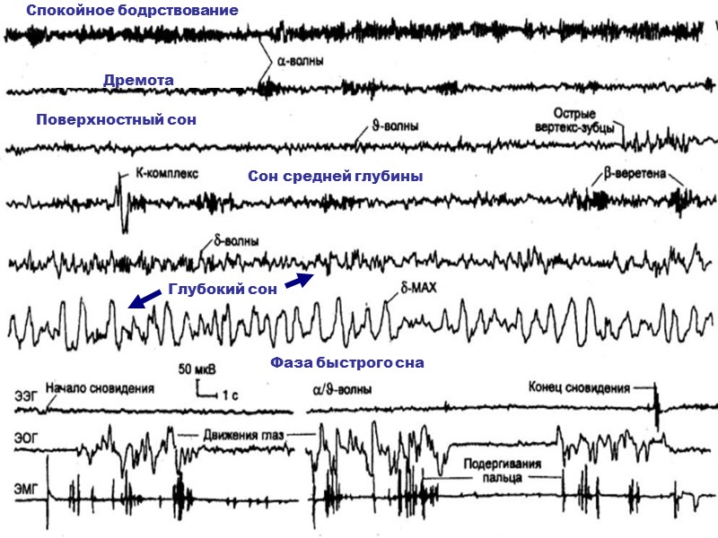 Спокойное бодрствование Поверхностный сон Дремота Сон средней глубины Глубокий сон Фаза быстрого сна